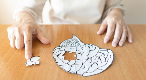 شيخوخة الدماغ