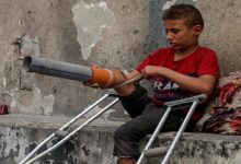 بتر الأطراف