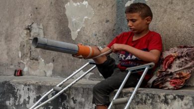 بتر الأطراف