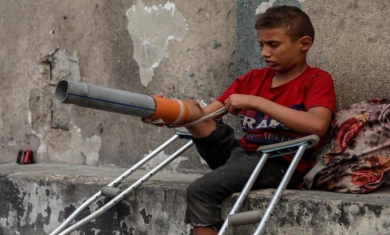 بتر الأطراف